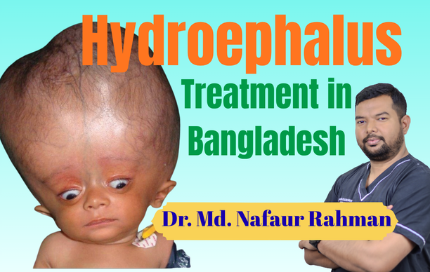 Pediatric hydrocephalus treatment in Bangladesh by pediatric neurosurgeon Dr. Md. Nafaur Rahman