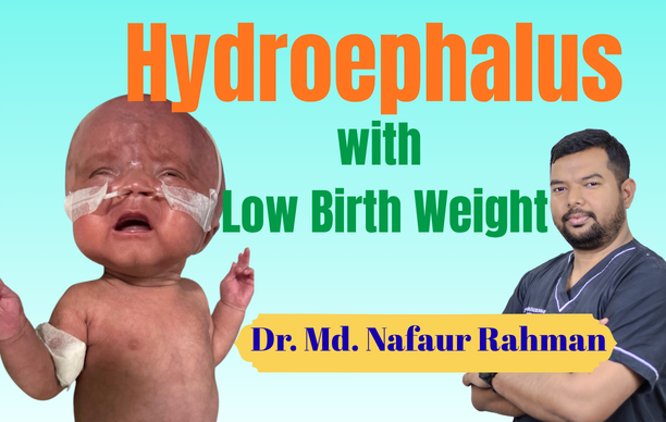 Low birth weight baby with hydrocephalus treatment in Bangladesh by pediatric neurosurgeon Dr. Md. Nafaur Rahman